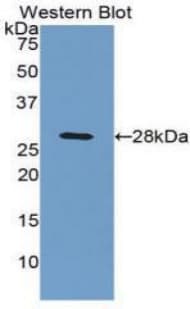 C4BPB / C4BP Beta Antibody (aa18-252)