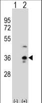 Polyclonal Rabbit anti-Human COLEC11 Antibody (aa50-78, IHC, WB)