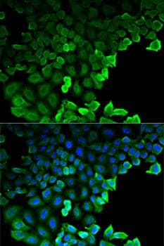 G6PD Antibody
