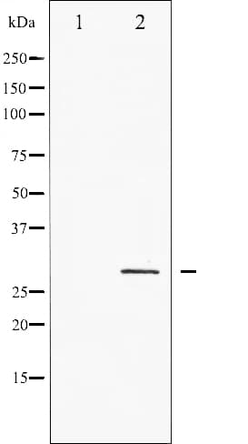 CDKN1B / p27 Kip1 Antibody (phospho-Thr198)