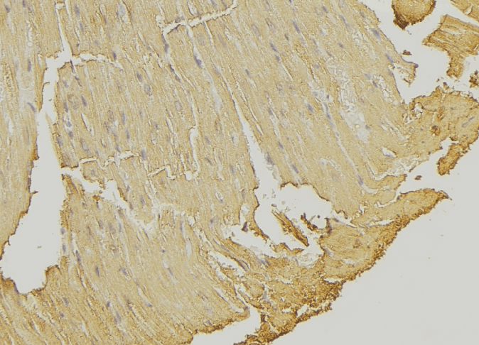 Polyclonal Rabbit anti-Human SSBP1 / mtSSB Antibody (IHC, IF, WB)