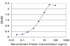 IHC-plus™ TNF Alpha Antibody (clone M 1 C4)