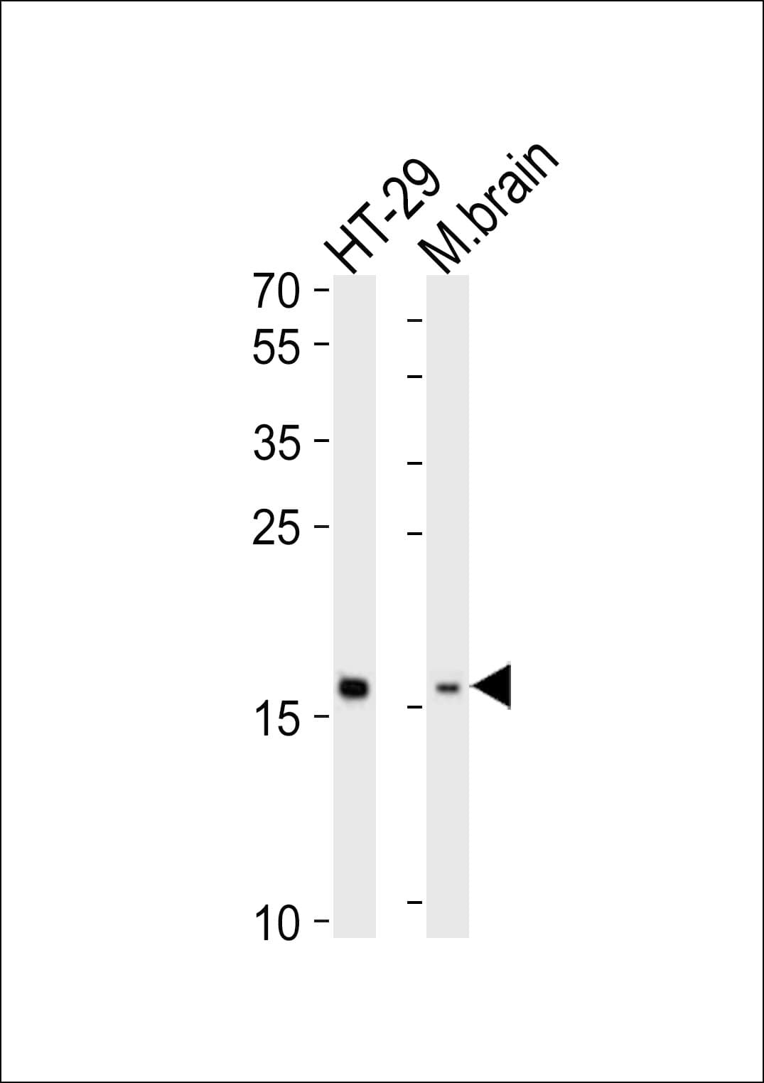 Polyclonal Rabbit anti-Human TMEM160 Antibody (aa32-64, WB)
