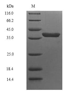 Escherichia coli insE1 Protein (Recombinant DDK,C-terminus)