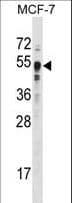 SETD7 / SET7 Antibody (aa159-189)