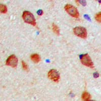 Polyclonal Rabbit anti-Human AURKA / Aurora-A Antibody (phospho-Thr288, IHC, IF, WB)