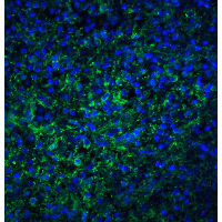 Polyclonal Rabbit anti-Human TLR4 Antibody (IHC, IF, WB)
