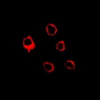ADGRE3 / EMR3 Antibody