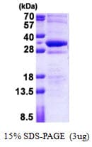 Human STMN4 / RB3 Protein (Recombinant His)