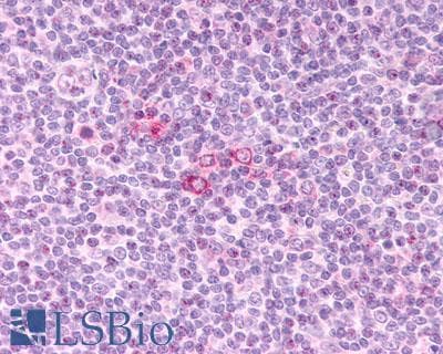 PathPlus™ CCR3 Antibody (C-Terminus)