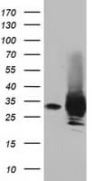 Monoclonal Mouse anti-Human P5CR2 / PYCR2 Antibody (clone OTI4A10, IF, WB)