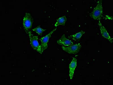 Polyclonal Rabbit anti-Human TFEB Antibody (IHC, IF)