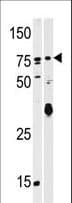 SCYL2 Antibody (aa643-672)