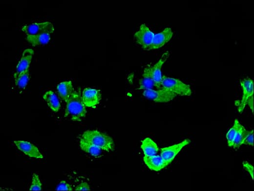 IHC-plus™ SLC16A3 Antibody