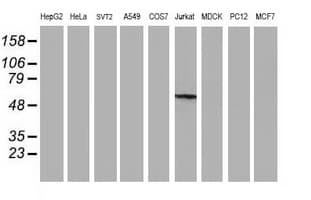 GBA3 / CBG Antibody (clone OTI1F1)