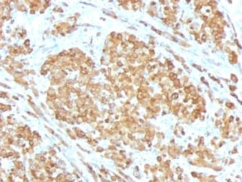 MLANA / Melan-A Antibody (clone SPM555)