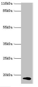 IHC-plus™ CALML5 Antibody (aa2-146)