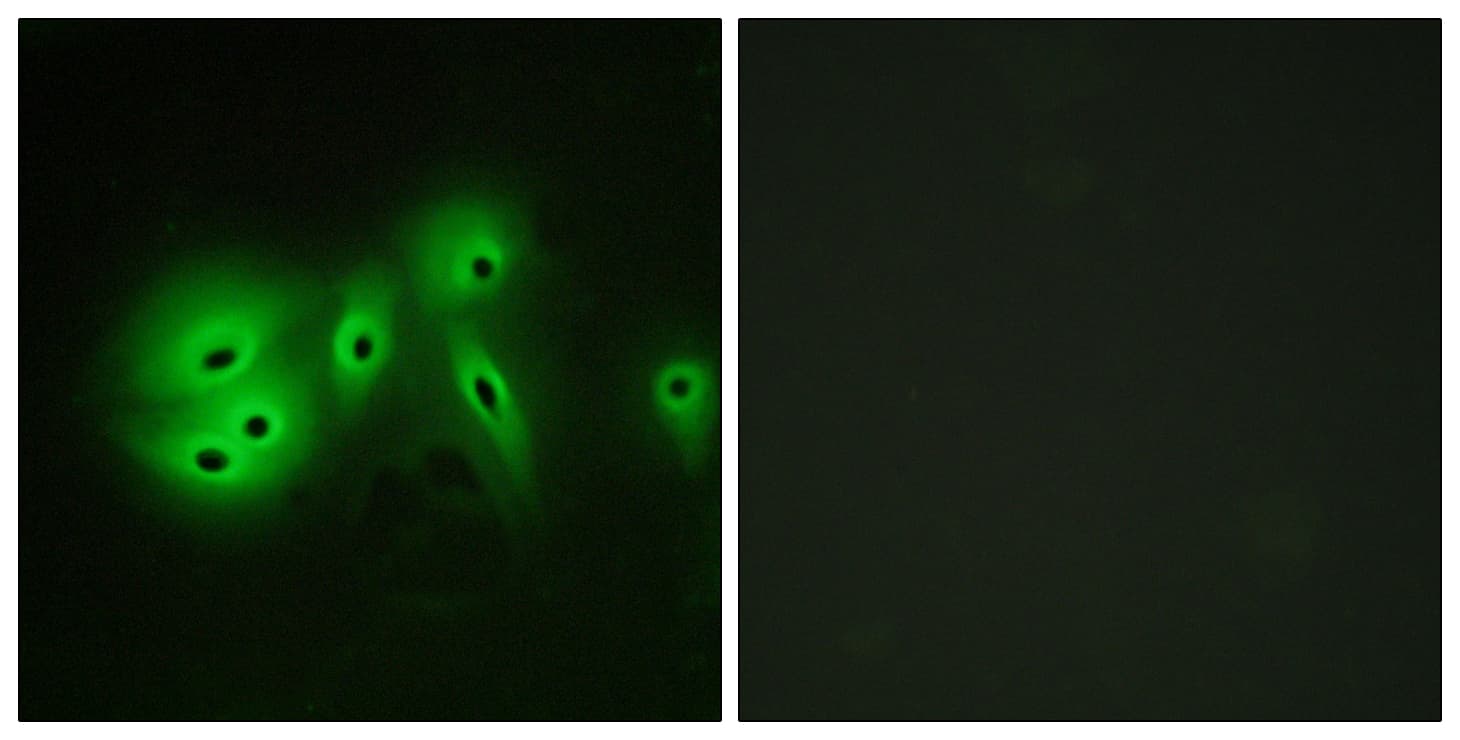 ADCY8 / Adenylate Cyclase 8 Antibody (aa591-640)