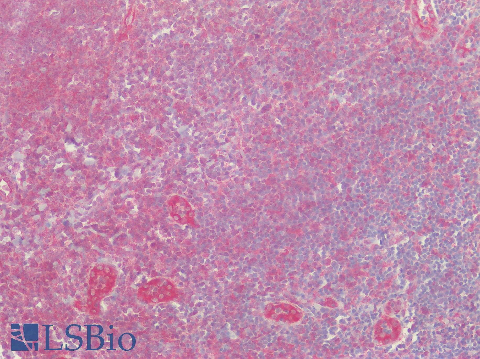 IHC-plus™ Polyclonal Rabbit anti-Human SLC29A1 / ENT1 Antibody (Internal, IHC)