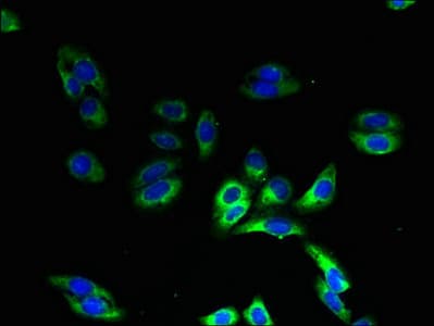 HIGD1B Antibody