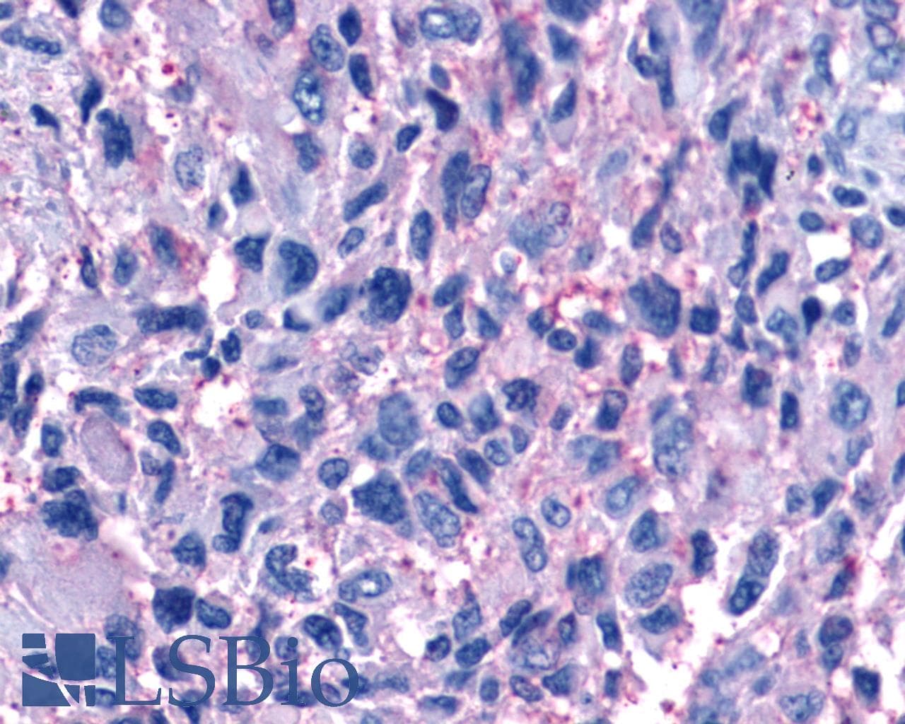IHC-plus™ Polyclonal Rabbit anti-Human P2RY11 / P2Y11 Antibody (Extracellular Domain, IHC)