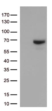 MMP2 Antibody (aa228-507, clone OTI4A11)