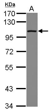 DDX23 / PRP28 Antibody