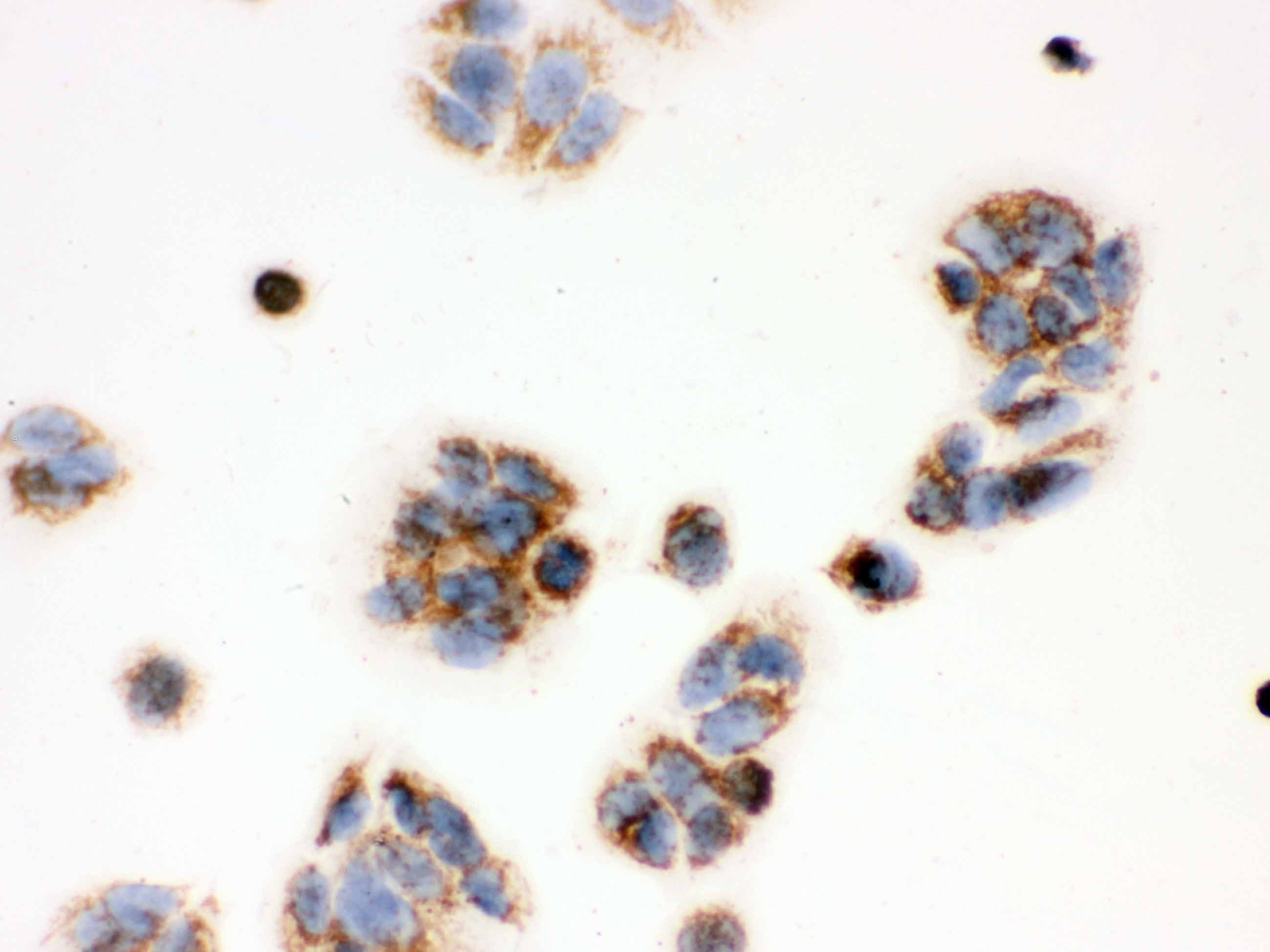 HSD17B10 / HADH2 Antibody (aa48-261)