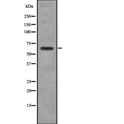 P2RX7 / P2X7 Antibody