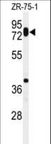 Polyclonal Rabbit anti-Human HAS1 / HAS Antibody (aa166-193, WB)