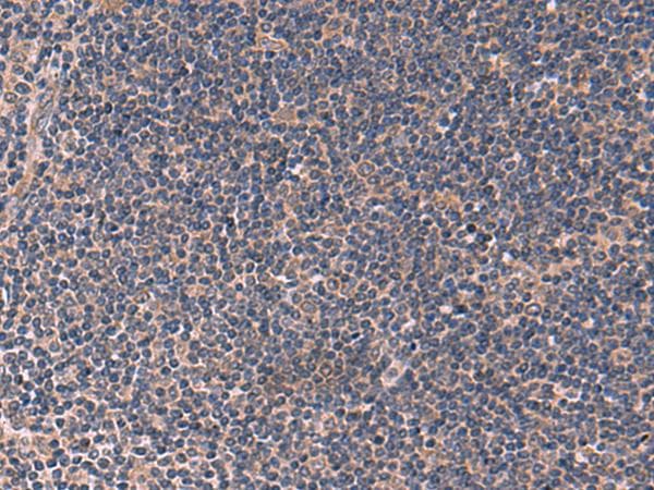 ITPR2 / IP3 Receptor Type 2 Antibody