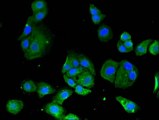 Polyclonal Rabbit anti-Human SIRT3 / Sirtuin 3 Antibody (IF, WB)