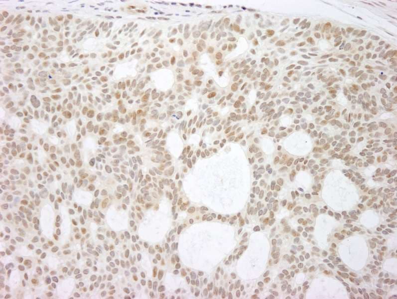 TP73 / p73 Antibody (aa1-62)
