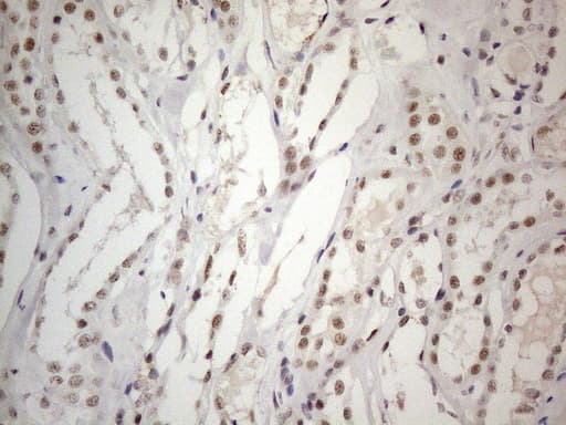Monoclonal Mouse anti-Human CWC27 Antibody (clone OTI4C8, aa145-472, IHC, WB)