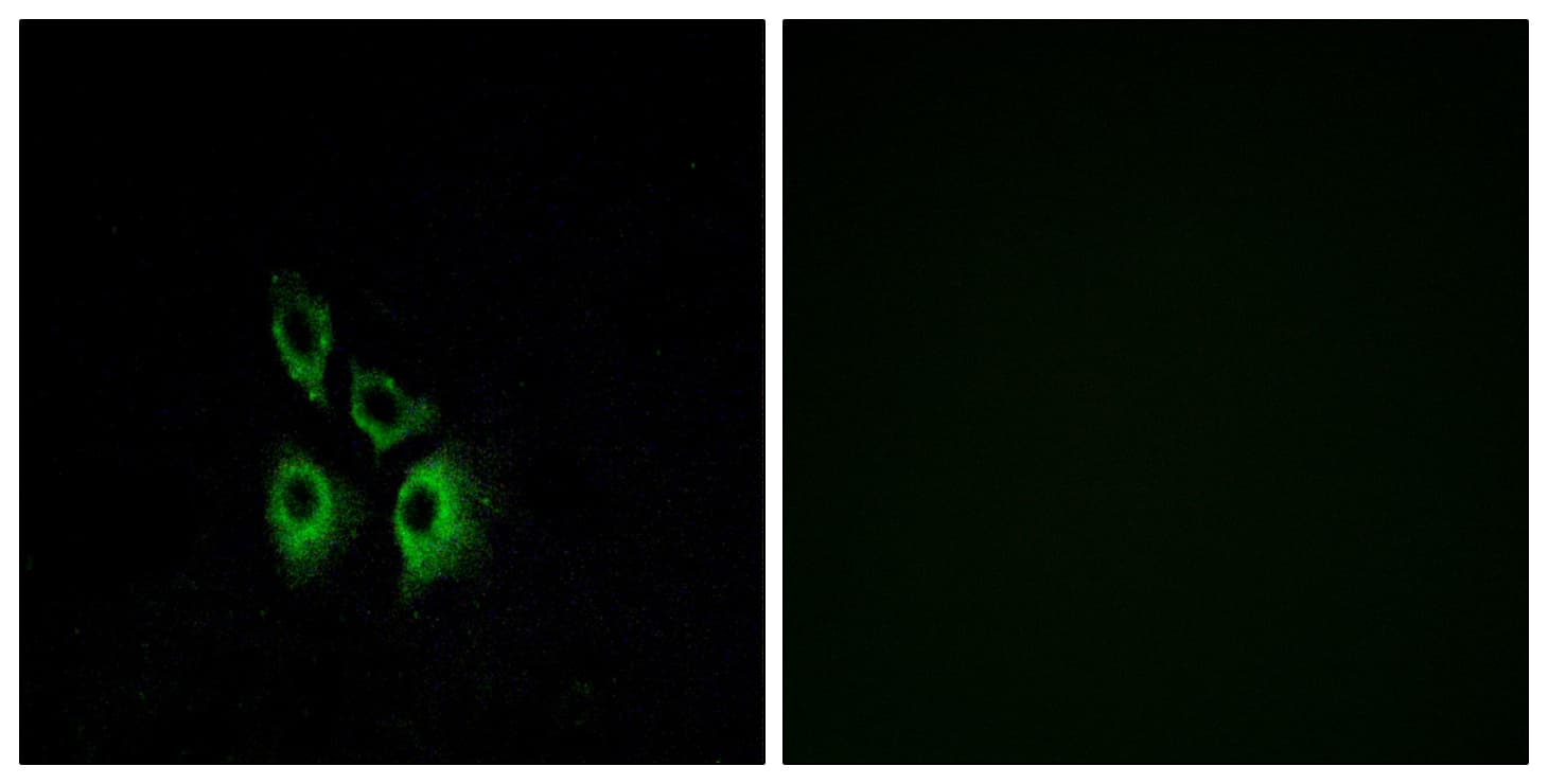 ADRA1A Antibody (aa136-185)