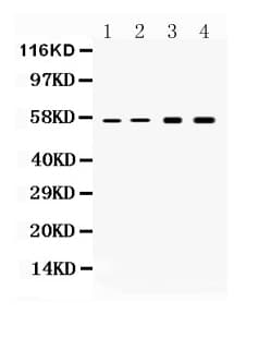 KRT18 / CK18 / Cytokeratin 18 Antibody