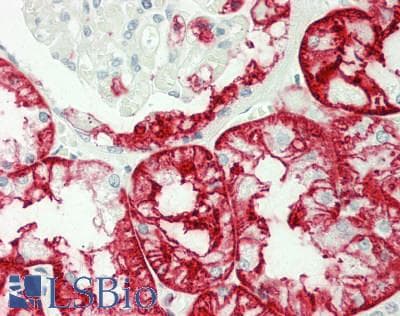 PathPlus™ Monoclonal Mouse anti-Human SSEA-1 / Lewis x / CD15 Antibody (clone AHN1.1, IHC)