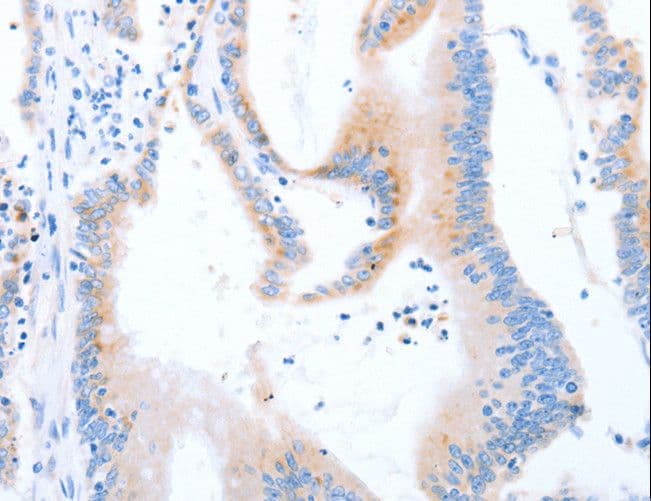 Polyclonal Rabbit anti-Human STK4 Antibody (IHC, WB)