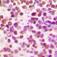 Polyclonal Rabbit anti-Human POU2F2 / OCT2 Antibody (N-Terminus, IHC, IF, WB)
