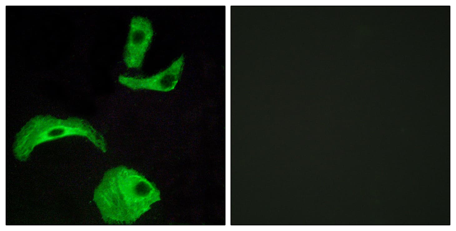 GPCRW / GPR18 Antibody (aa131-180)