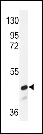 SMAD2 Antibody (Ser118)