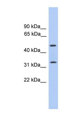 TPRG1 Antibody (C-Terminus)