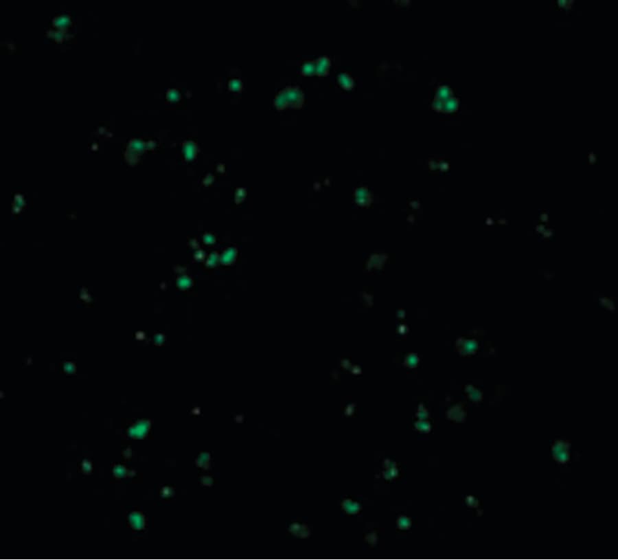 IHC-plus™ Polyclonal Rabbit anti-Human CARD8 / Cardinal / TUCAN Antibody (IHC, IF, WB)