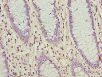 SLC30A6 Antibody