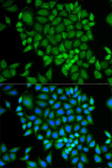 GLRX / Glutaredoxin Antibody