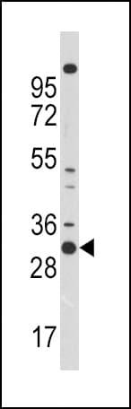 Polyclonal Rabbit anti-Human CDK1 / CDC2 Antibody (aa1-29, WB)