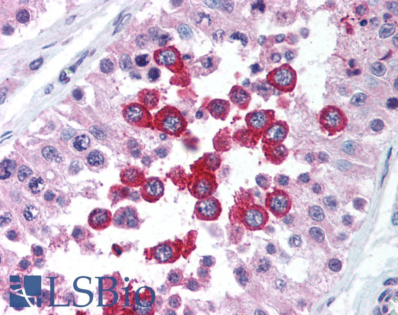 IHC-plus™ Polyclonal Rabbit anti-Human RNF216 / TRIAD3 Antibody (IHC, IF, WB)