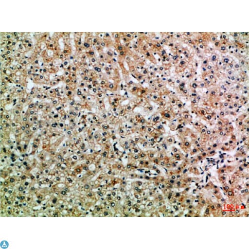 PPP1R13B Antibody