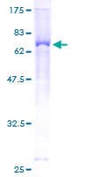 Human ENPP5 Protein (Recombinant GST)