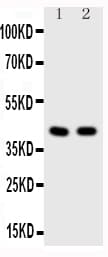 HDAC8 Antibody (aa18-33)